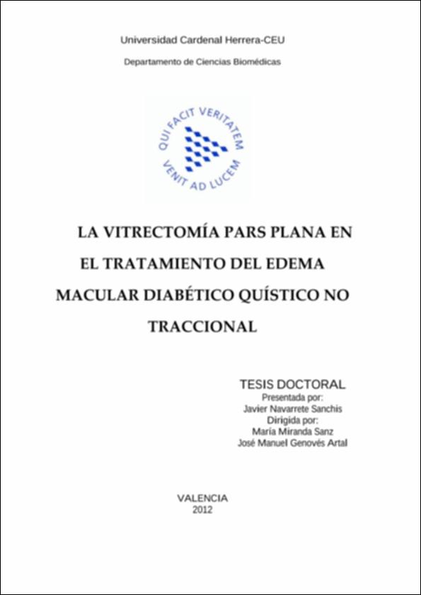 Vitrectomía_Navarrete_UCHCEU_Tesis_2012.pdf.jpg