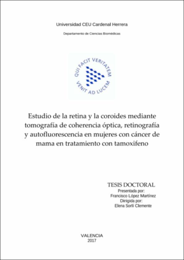 Estudio_Lopez_UCHCEU_Tesis_2017.pdf.jpg