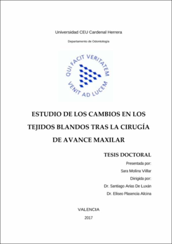 Estudio_Molina_UCHCEU_Tesis_2017.pdf.jpg