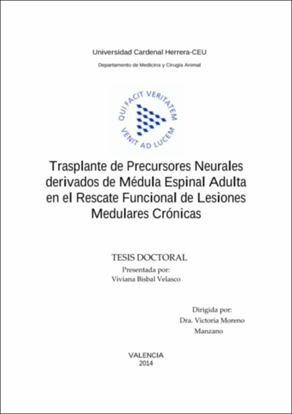 Trasplante_Bisbal_UCHCEU_Tesis_2015.pdf.jpg