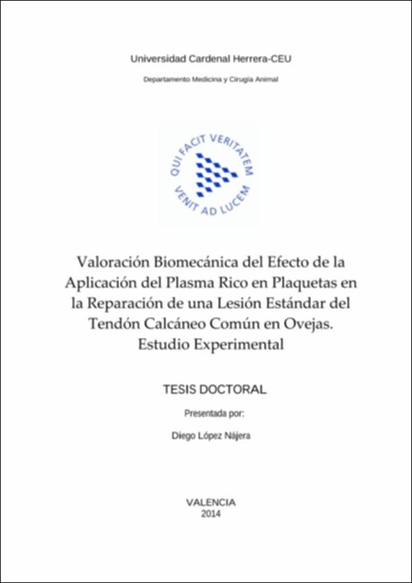 Valoracion_Lopez_UCHCEU_Tesis_2014.pdf.jpg