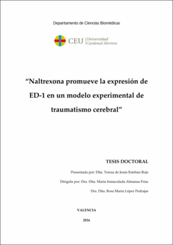 Naltrexona_Esteban_UCHCEU_Tesis_2016.pdf.jpg